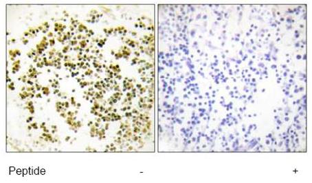 Immunohistochemistry (Formalin/PFA-fixed paraffin-embedded sections) - Anti-MSC antibody (AB64954), expandable thumbnail