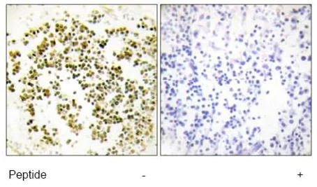 Immunohistochemistry (Formalin/PFA-fixed paraffin-embedded sections) - Anti-MSC antibody (AB64954)