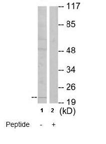 Western blot - Anti-MSC antibody (AB64954), expandable thumbnail