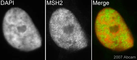 Immunocytochemistry/ Immunofluorescence - Anti-MSH2 antibody [3A2B8C] (AB52266)