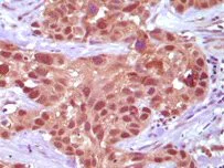 Immunohistochemistry (Formalin/PFA-fixed paraffin-embedded sections) - Anti-MSH2 antibody [3A2B8C] (AB52266)