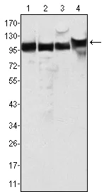 Western blot - Anti-MSH2 antibody [3A2B8C] (AB52266)