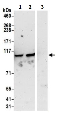 Immunoprecipitation - Anti-MSH2 antibody (AB245383)