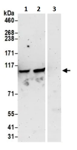 Immunoprecipitation - Anti-MSH2 antibody (AB245383)