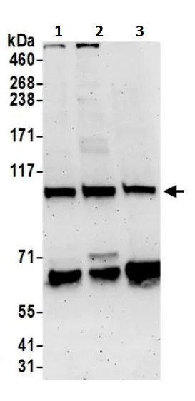 Western blot - Anti-MSH2 antibody (AB245383)