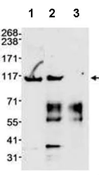 Immunoprecipitation - Anti-MSH2 antibody (AB70270)