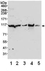 Western blot - Anti-MSH2 antibody (AB70270)
