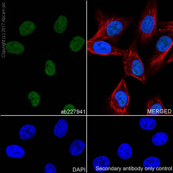 Immunocytochemistry/ Immunofluorescence - Anti-MSH2 antibody [EPR21017-123] (AB227941)