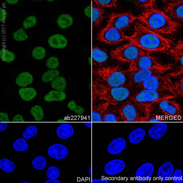 Immunocytochemistry/ Immunofluorescence - Anti-MSH2 antibody [EPR21017-123] (AB227941)