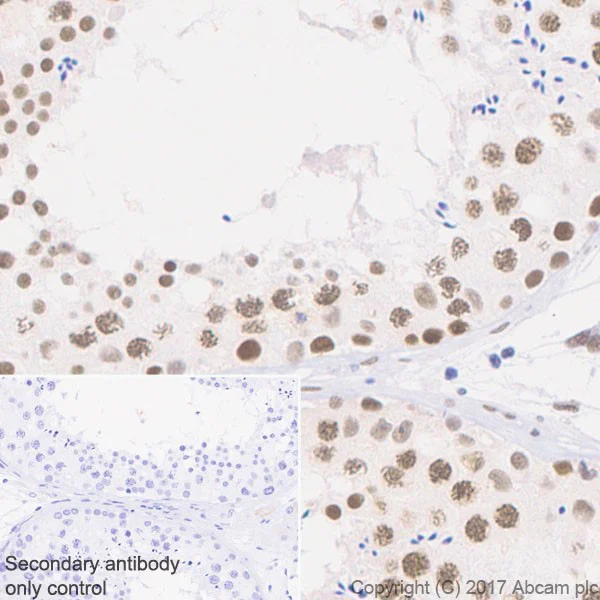 Immunohistochemistry (Formalin/PFA-fixed paraffin-embedded sections) - Anti-MSH2 antibody [EPR21017-123] (AB227941)