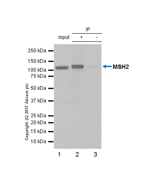 Immunoprecipitation - Anti-MSH2 antibody [EPR21017-123] (AB227941)