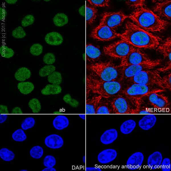 Immunocytochemistry/ Immunofluorescence - Anti-MSH2 antibody [EPR21017-123] - BSA and Azide free (AB228334)