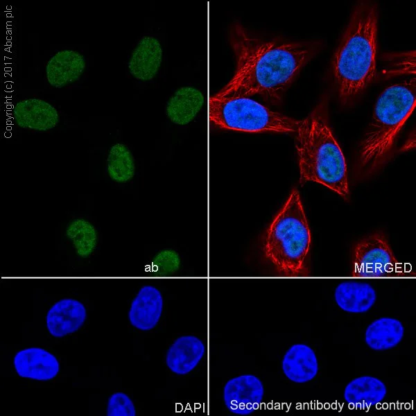 Immunocytochemistry/ Immunofluorescence - Anti-MSH2 antibody [EPR21017-123] - BSA and Azide free (AB228334)