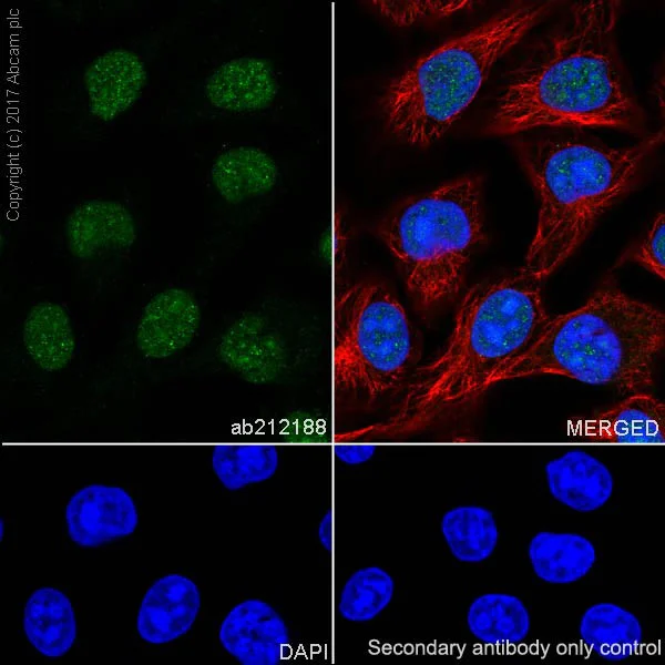 Immunocytochemistry/ Immunofluorescence - Anti-MSH2 antibody [EPR21017-2] (AB212188)