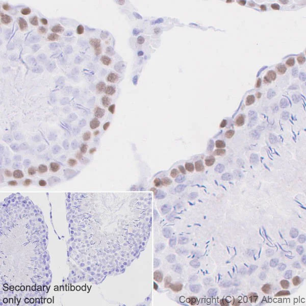 Immunohistochemistry (Formalin/PFA-fixed paraffin-embedded sections) - Anti-MSH2 antibody [EPR21017-2] (AB212188)
