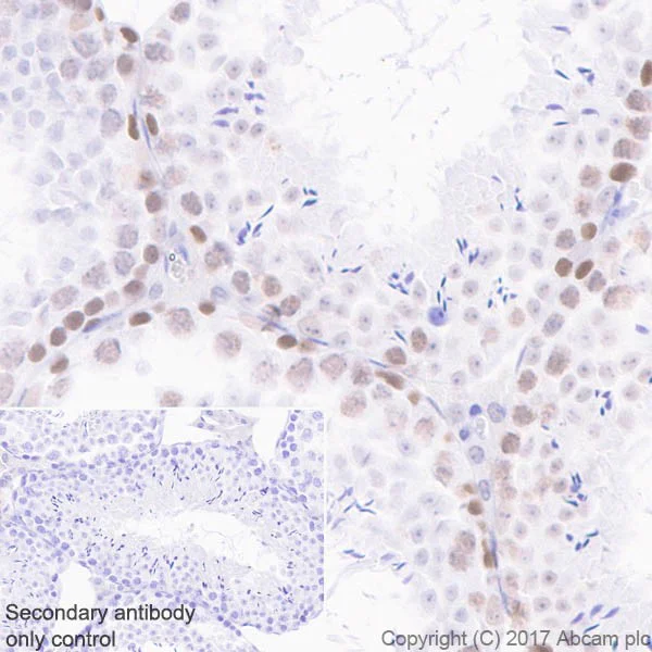 Immunohistochemistry (Formalin/PFA-fixed paraffin-embedded sections) - Anti-MSH2 antibody [EPR21017-2] (AB212188)