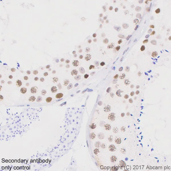 Immunohistochemistry (Formalin/PFA-fixed paraffin-embedded sections) - Anti-MSH2 antibody [EPR21017-2] - BSA and Azide free (AB228325)