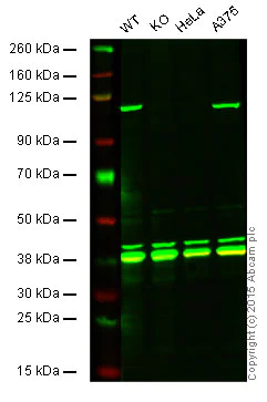 Western blot - Anti-MSH2 antibody [EPR3943] (AB92473)