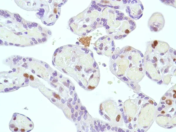Immunohistochemistry (Formalin/PFA-fixed paraffin-embedded sections) - Anti-MSH2 antibody [SP46] (AB231437)