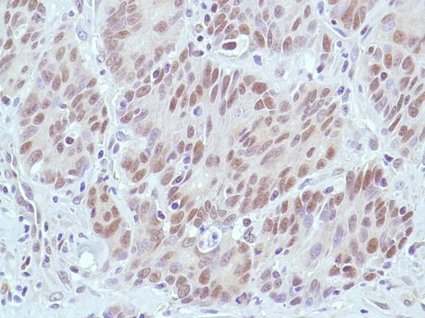 Immunohistochemistry (Formalin/PFA-fixed paraffin-embedded sections) - Anti-MSH2 antibody [SP46] (AB231437)