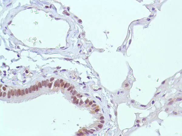 Immunohistochemistry (Formalin/PFA-fixed paraffin-embedded sections) - Anti-MSH2 antibody [SP46] (AB231437)