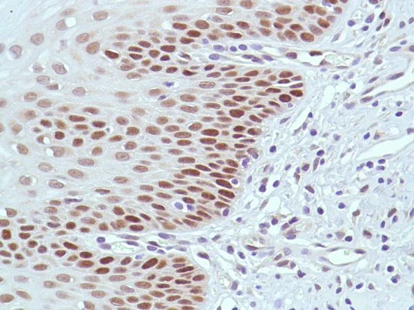 Immunohistochemistry (Formalin/PFA-fixed paraffin-embedded sections) - Anti-MSH2 antibody [SP46] (AB231437)