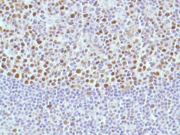 Immunohistochemistry (Formalin/PFA-fixed paraffin-embedded sections) - Anti-MSH2 antibody [SP46] (AB231437)