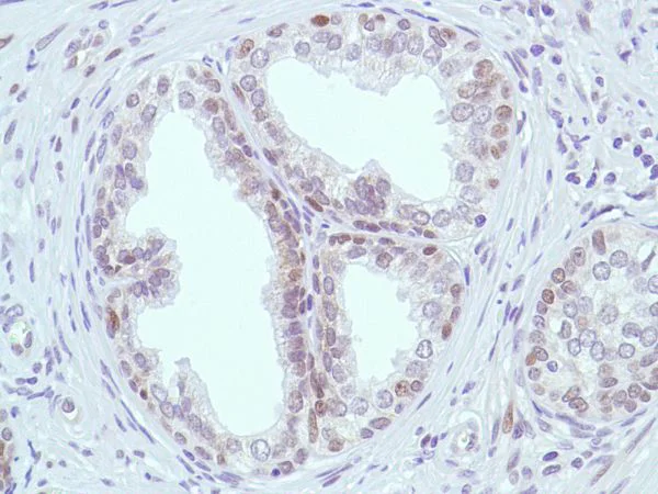 Immunohistochemistry (Formalin/PFA-fixed paraffin-embedded sections) - Anti-MSH2 antibody [SP46] (AB231437)
