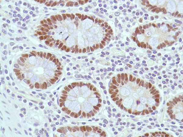 Immunohistochemistry (Formalin/PFA-fixed paraffin-embedded sections) - Anti-MSH2 antibody [SP46] (AB231437)