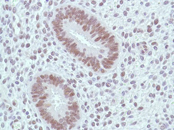 Immunohistochemistry (Formalin/PFA-fixed paraffin-embedded sections) - Anti-MSH2 antibody [SP46] (AB231437)