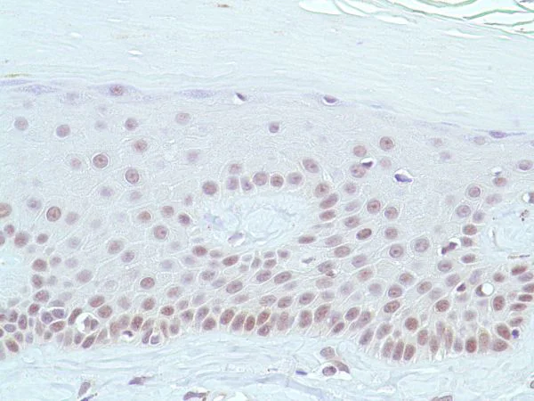 Immunohistochemistry (Formalin/PFA-fixed paraffin-embedded sections) - Anti-MSH2 antibody [SP46] (AB231437)
