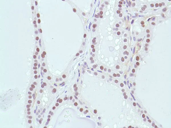 Immunohistochemistry (Formalin/PFA-fixed paraffin-embedded sections) - Anti-MSH2 antibody [SP46] (AB231437)