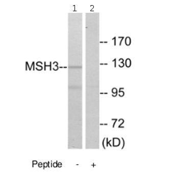 Western blot - Anti-MSH3 antibody (AB69619), expandable thumbnail