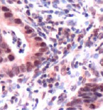 Immunohistochemistry (Formalin/PFA-fixed paraffin-embedded sections) - Anti-MSH3 antibody (AB93663), expandable thumbnail