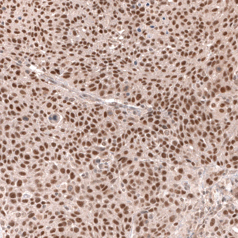 Immunohistochemistry (Formalin/PFA-fixed paraffin-embedded sections) - Anti-MSH3 Antibody [CL14059] (AB327151)