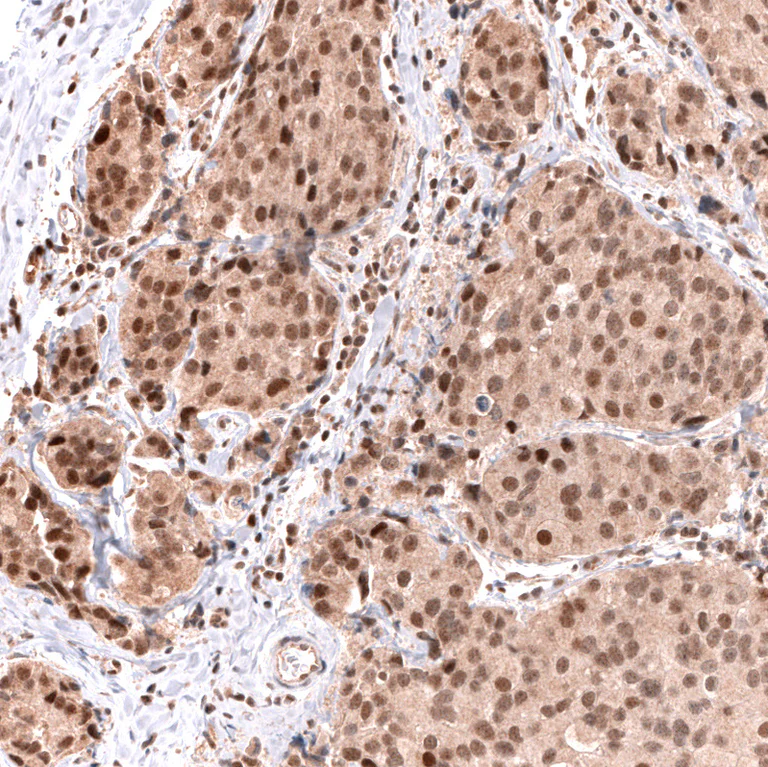 Immunohistochemistry (Formalin/PFA-fixed paraffin-embedded sections) - Anti-MSH3 Antibody [CL14059] (AB327151)