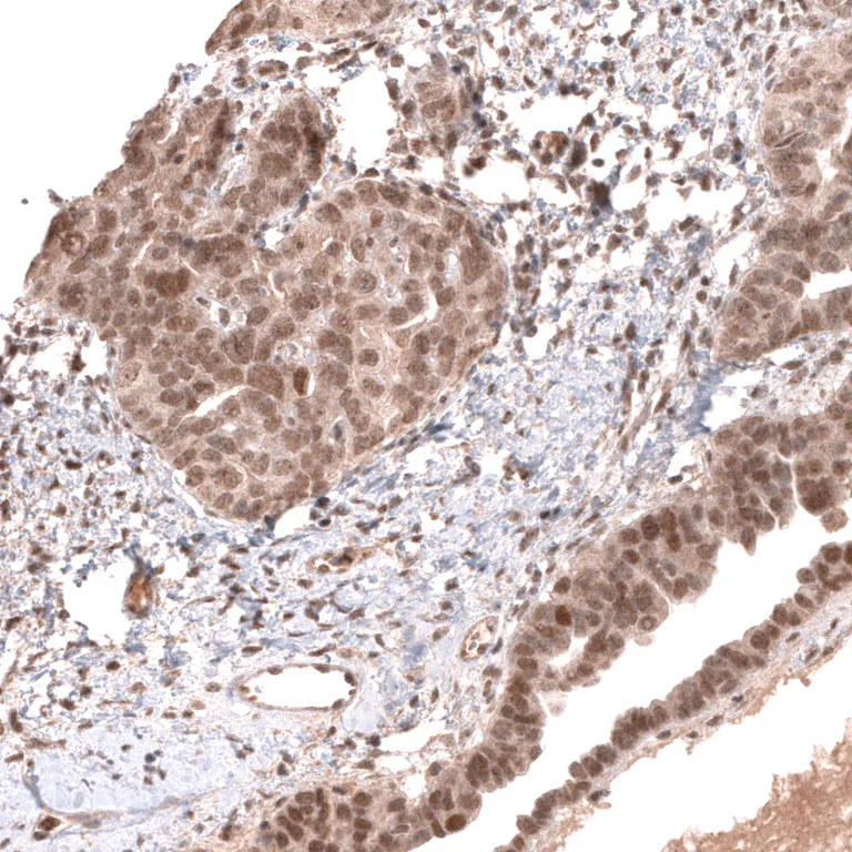 Immunohistochemistry (Formalin/PFA-fixed paraffin-embedded sections) - Anti-MSH3 Antibody [CL14059] (AB327151)