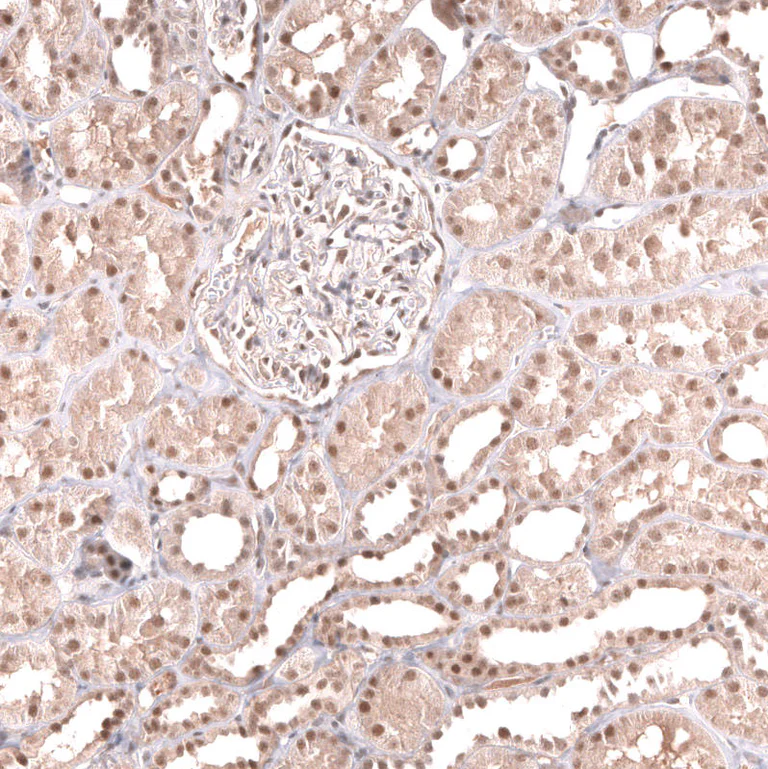 Immunohistochemistry (Formalin/PFA-fixed paraffin-embedded sections) - Anti-MSH3 Antibody [CL14059] (AB327151)