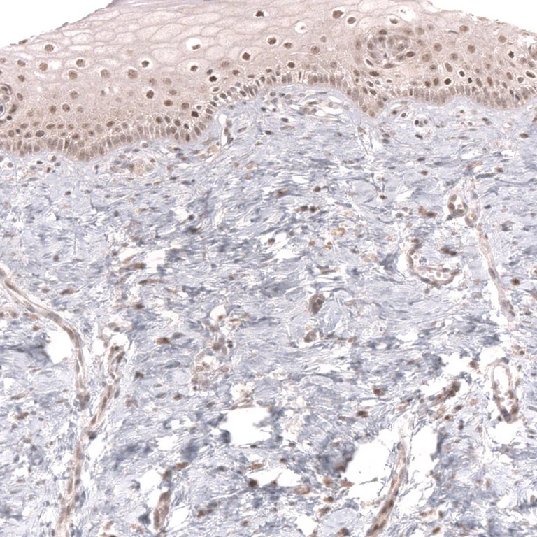 Immunohistochemistry (Formalin/PFA-fixed paraffin-embedded sections) - Anti-MSH3 Antibody [CL14059] (AB327151)