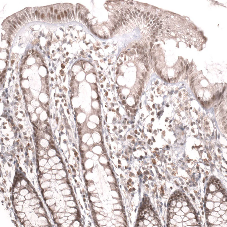 Immunohistochemistry (Formalin/PFA-fixed paraffin-embedded sections) - Anti-MSH3 Antibody [CL14059] (AB327151)