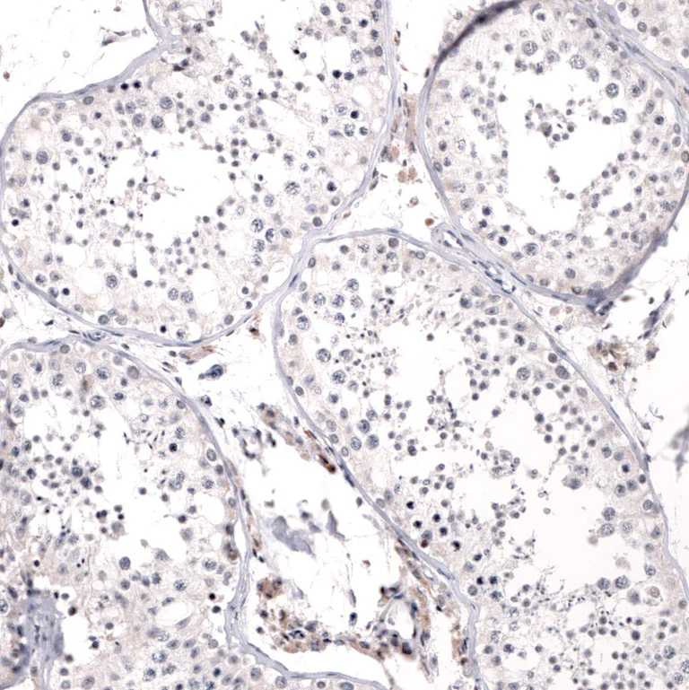 Immunohistochemistry (Formalin/PFA-fixed paraffin-embedded sections) - Anti-MSH3 Antibody [CL14059] (AB327151)