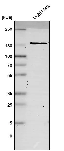 Western blot - Anti-MSH3 Antibody [CL14059] (AB327151)