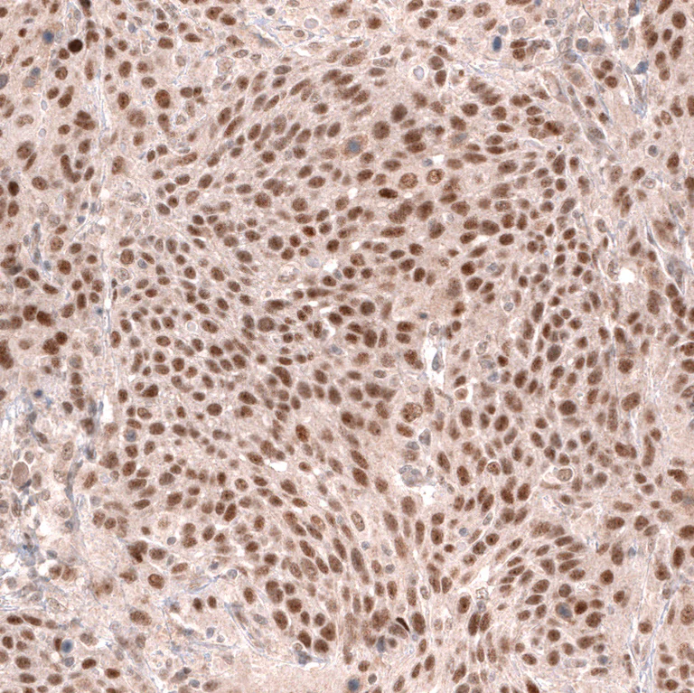 Immunohistochemistry (Formalin/PFA-fixed paraffin-embedded sections) - Anti-MSH3 Antibody [CL14064] (AB327152)