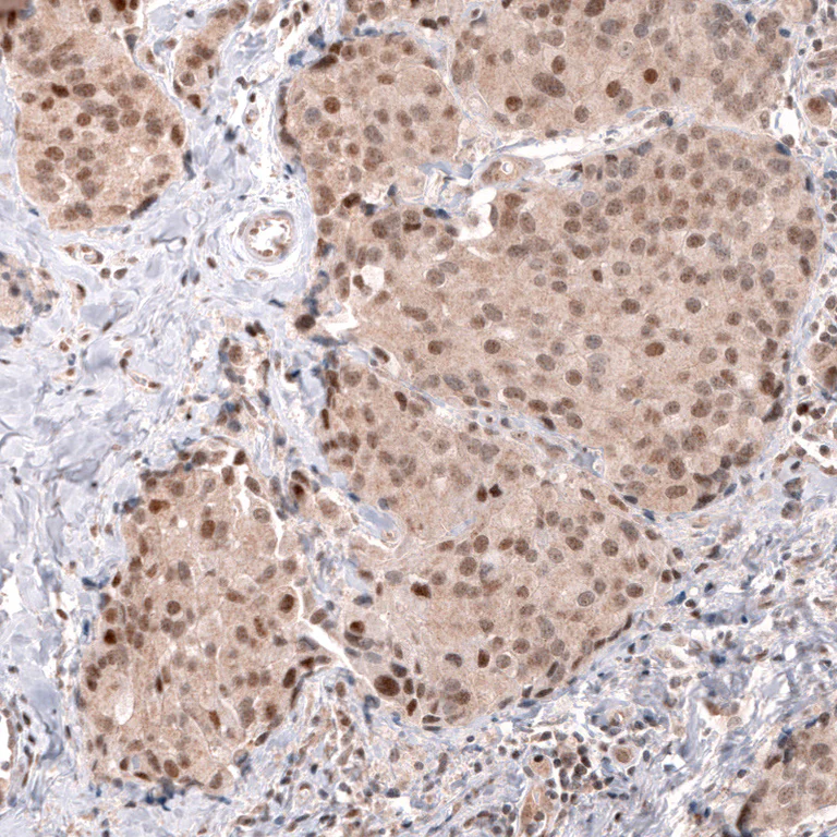 Immunohistochemistry (Formalin/PFA-fixed paraffin-embedded sections) - Anti-MSH3 Antibody [CL14064] (AB327152)