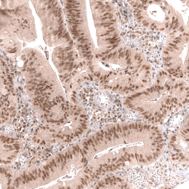 Immunohistochemistry (Formalin/PFA-fixed paraffin-embedded sections) - Anti-MSH3 Antibody [CL14064] (AB327152)