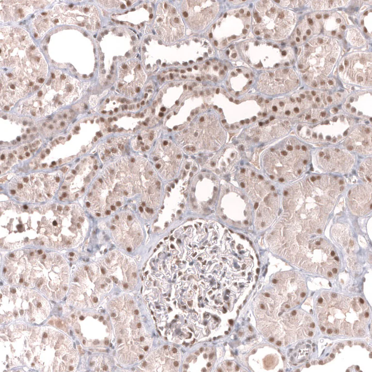 Immunohistochemistry (Formalin/PFA-fixed paraffin-embedded sections) - Anti-MSH3 Antibody [CL14064] (AB327152)