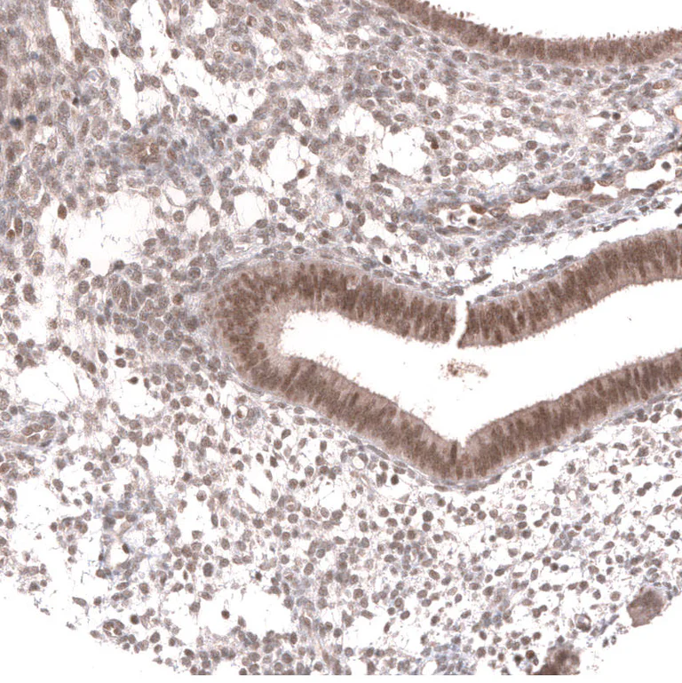 Immunohistochemistry (Formalin/PFA-fixed paraffin-embedded sections) - Anti-MSH3 Antibody [CL14064] (AB327152)