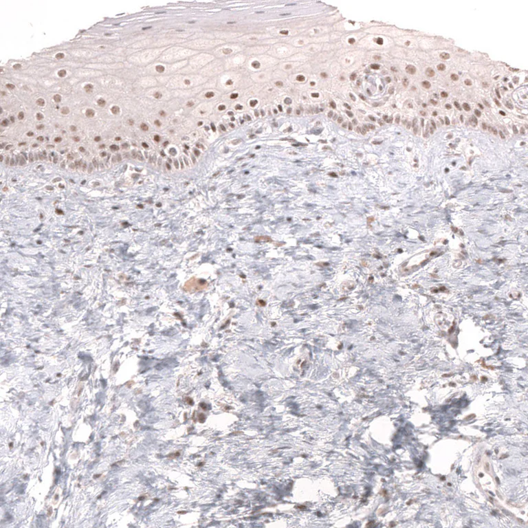 Immunohistochemistry (Formalin/PFA-fixed paraffin-embedded sections) - Anti-MSH3 Antibody [CL14064] (AB327152)