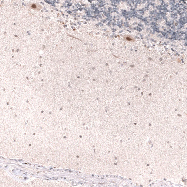 Immunohistochemistry (Formalin/PFA-fixed paraffin-embedded sections) - Anti-MSH3 Antibody [CL14064] (AB327152)