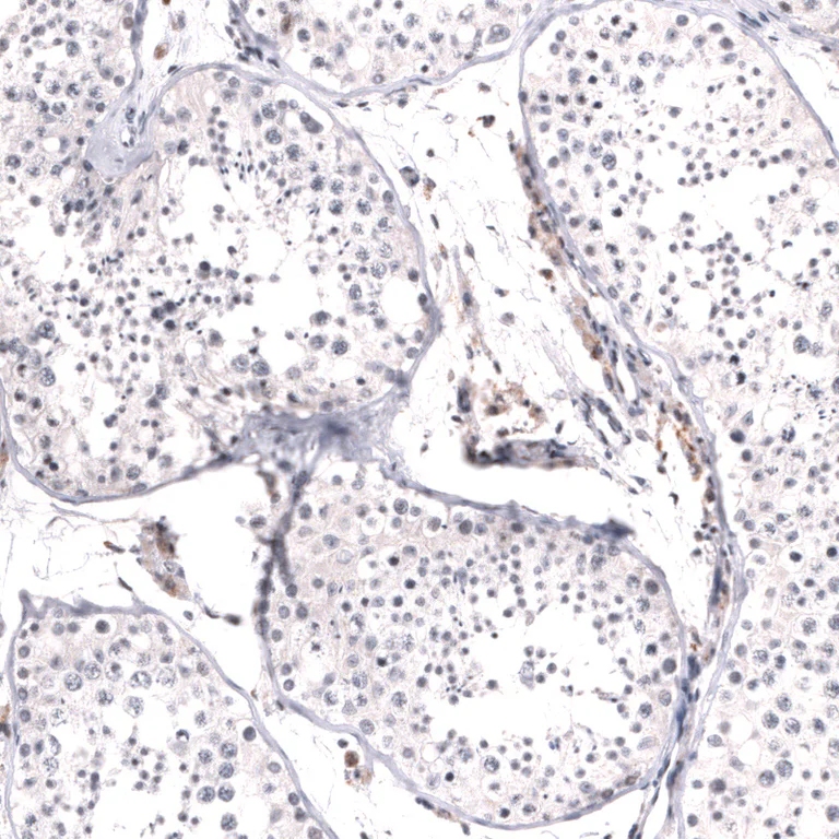 Immunohistochemistry (Formalin/PFA-fixed paraffin-embedded sections) - Anti-MSH3 Antibody [CL14064] (AB327152)